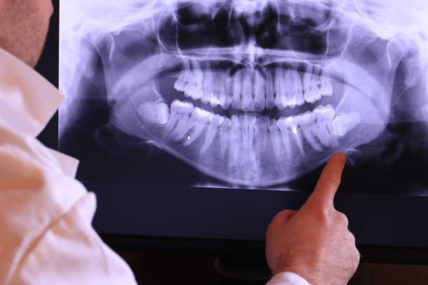 Best Broken or Chipped Tooth Repair in Harriman, TN